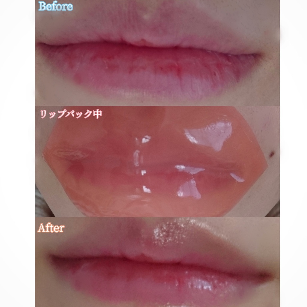 [Mãu mới 2022] Mặt nạ dưỡng môi Choosy Lip Pack Nhật Bản - Dưỡng ẩm môi, ngực hồng mềm mại mịn màng, giảm thâm khô