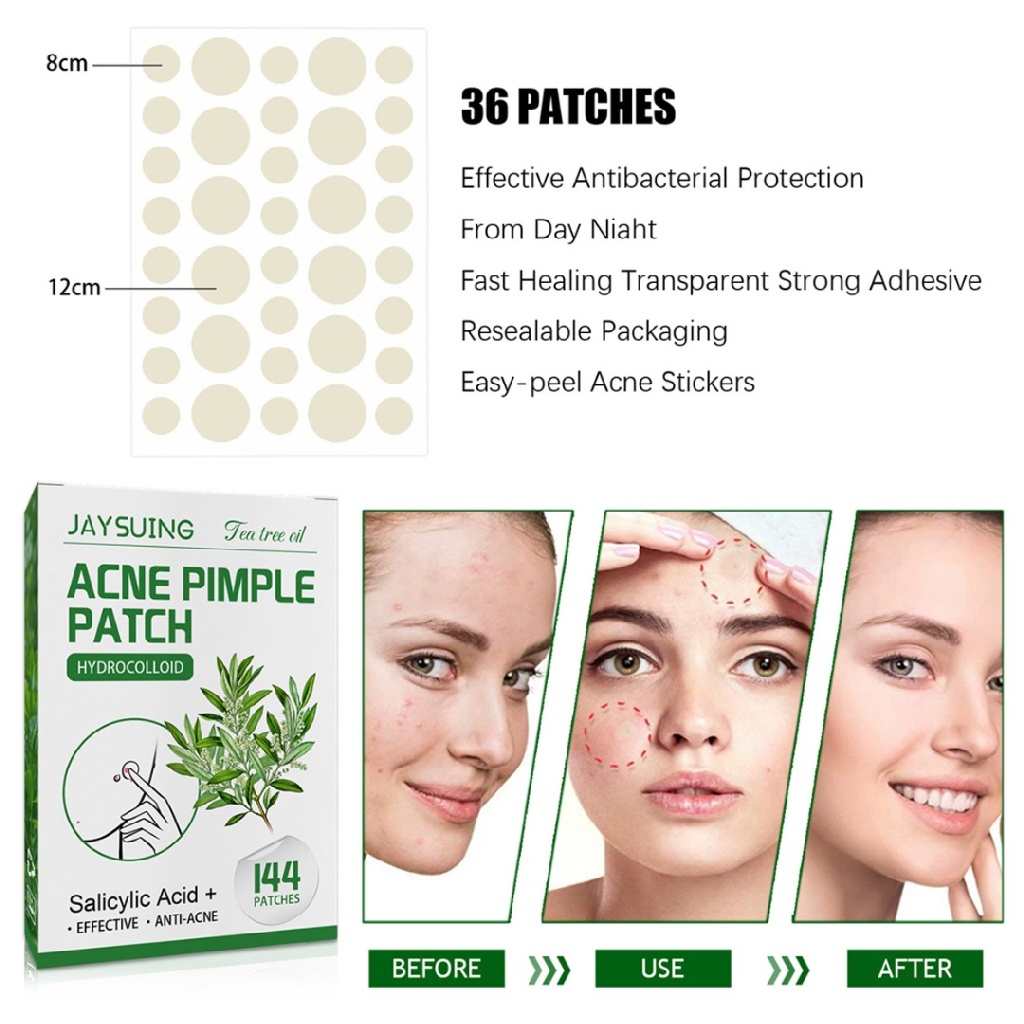 [Hàng mới về] Set 144 miếng dán mụn vô hình siêu mỏng