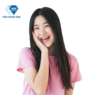 E-Voucher Nha Khoa Kim dịch vụ niềng răng mắc cài sứ
