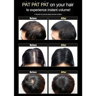 Phấn Dashu chống rụng tóc, hair cushion 26g [sunflower1968]