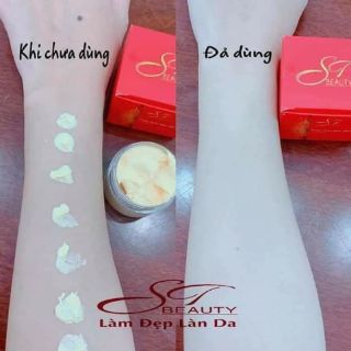 Kích siêu trắng
