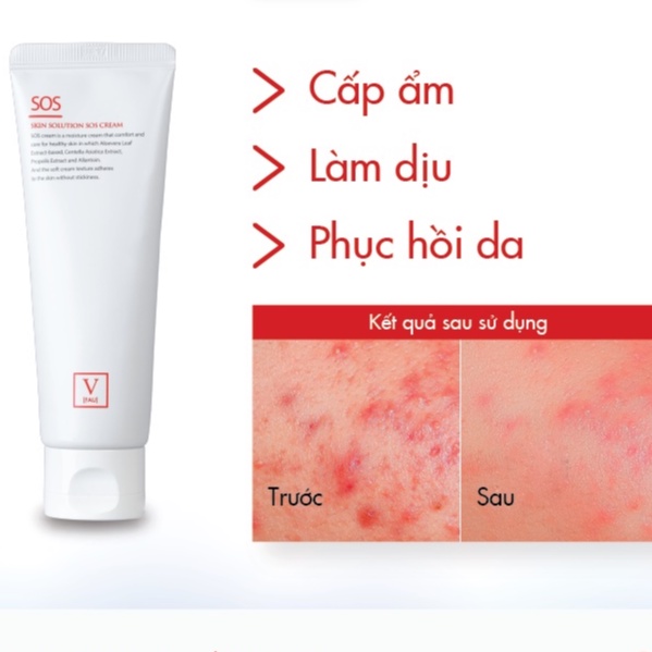 Kem dưỡng ẩm, làm dịu và phục hồi da FAU SOS Cream  – HANAH SKIN