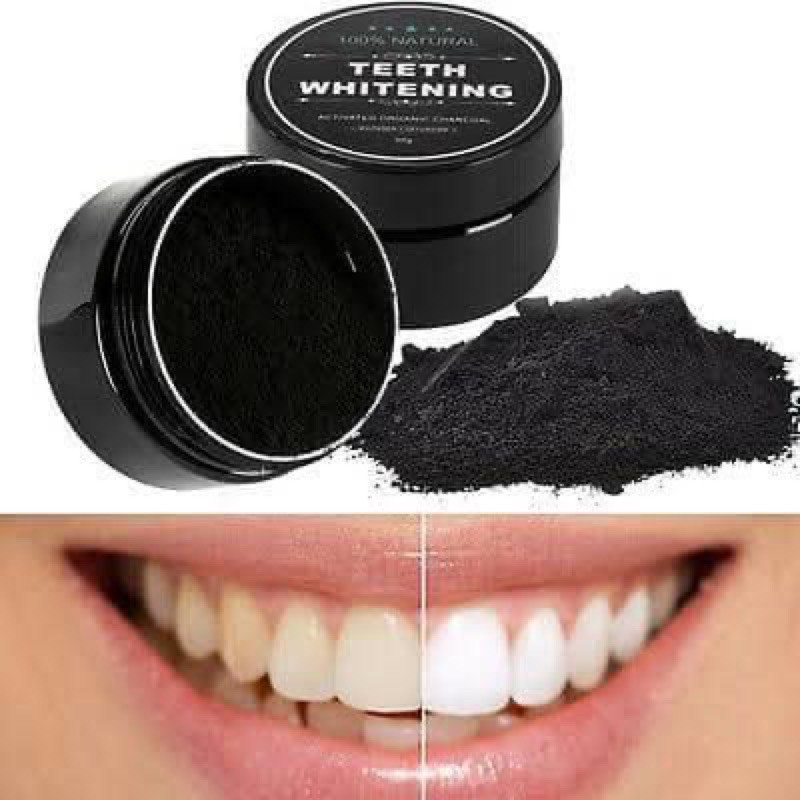 BỘT THAN HOẠT TÍNH TRẮNG RĂNG White Glo Activated Charcoal Teeth Polishing Powder 30g ( Úc)