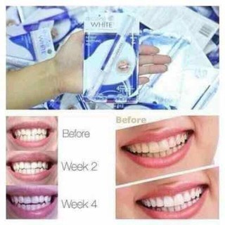 BÚT TẨY TRẮNG RĂNG #DAZZLING WHITE