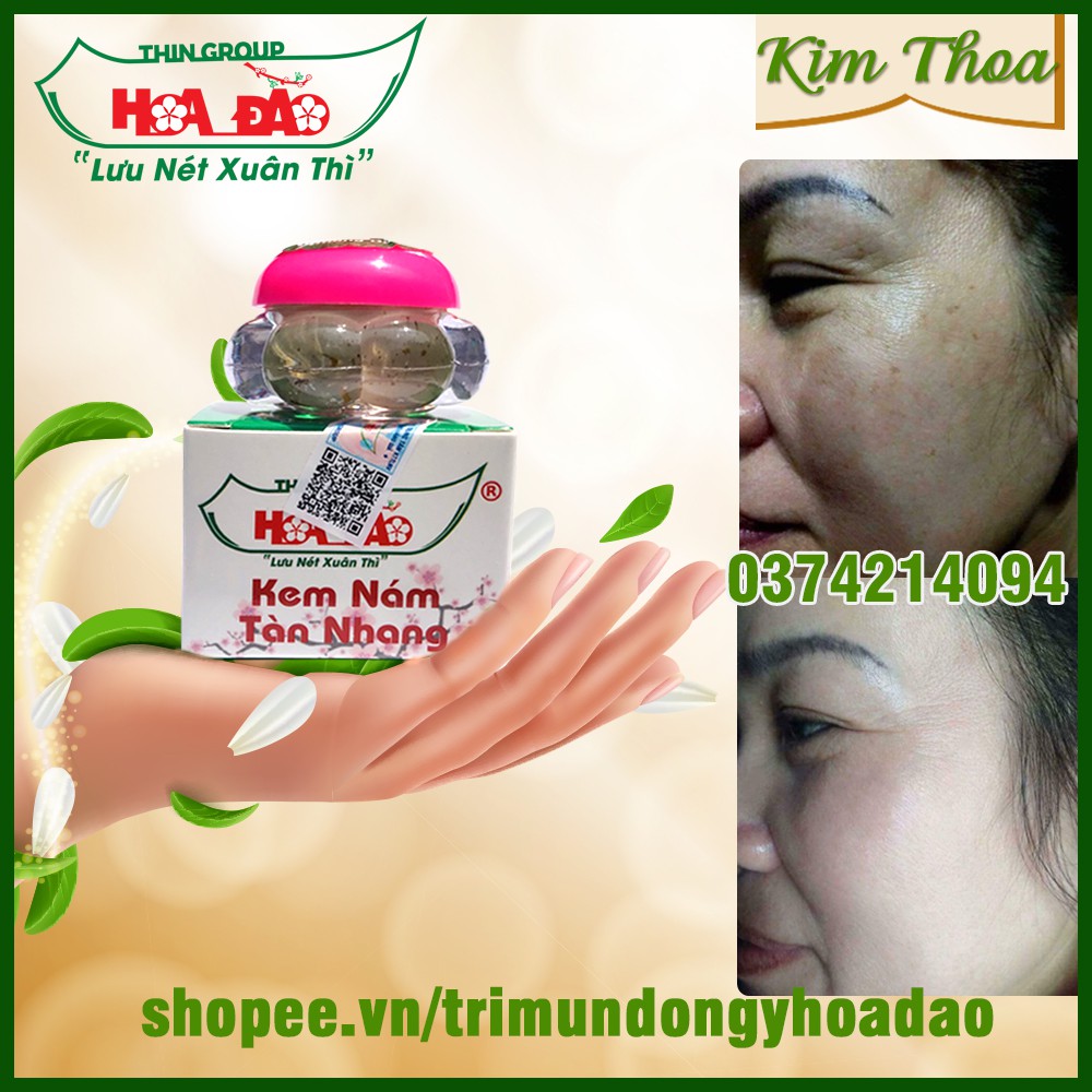 Kem Nám Tàn Nhang Hoa Đào Thingroup Chính Hãng