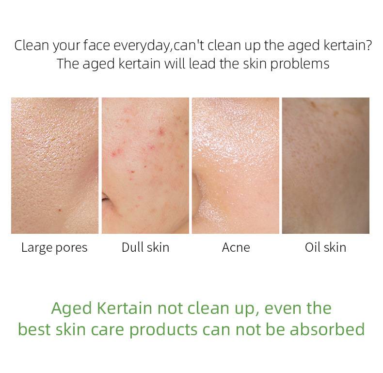 [Hàng mới về] Gel Tẩy Tế Bào Chết Laikou Chiết Xuất Trà Xanh Tự Nhiên Cho Làn Da 60g