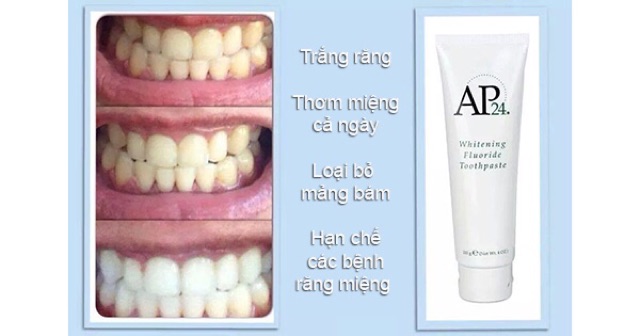 Kem đánh trắng răng AP24