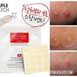 DÁN MỤN COSRX ACNES PIMPLE MASTER PATCH