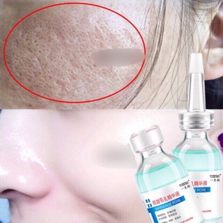 Tinh chất dưỡng shrinkage pore 30ml G204