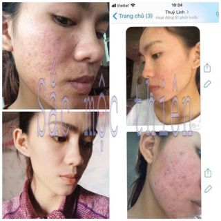 TINH CHẤT TÁI TẠO DA SẮC MỘC THIÊN