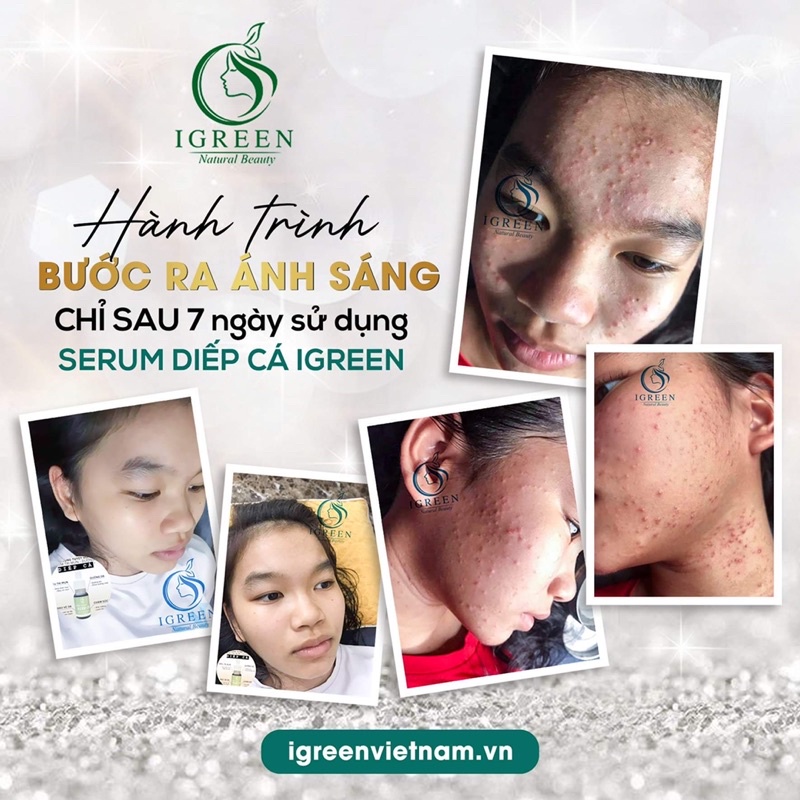 Serum IGREEN căng bóng, mịn màng