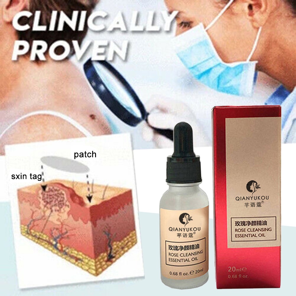 Dung dịch loại bỏ Mole hiệu quả cho da mặt 20ml | BigBuy360 - bigbuy360.vn