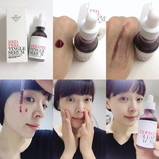 (MẪU MỚI 2020) Thay da sinh học Red Peel Tingle Serum