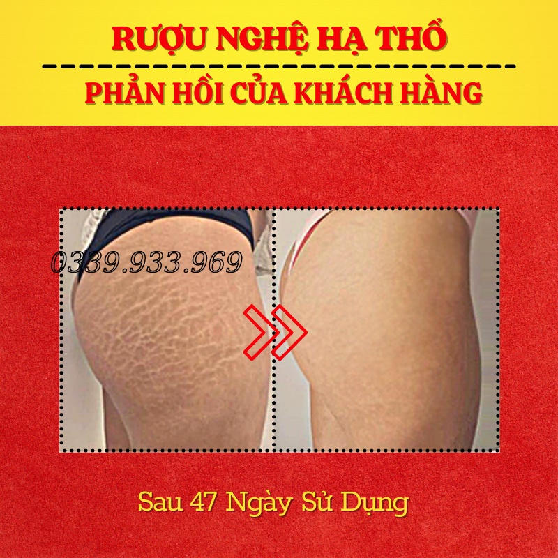 Rượu Nghệ Vàng Hạ Thổ I'm Nature Làm Mờ Thâm Rạn - Sáng Da - Se Khít Chân Lông (500ml)