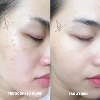 [sẵn] Bút chấm Anti Pickment Eucerin 5ml
