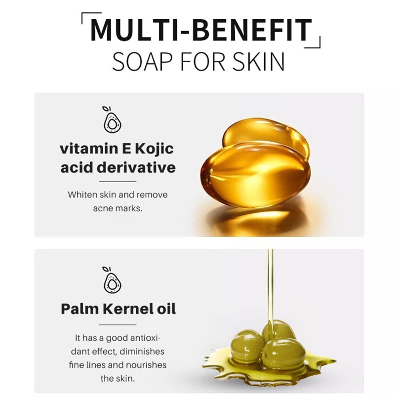 Xà Phòng Tắm Axit Kojic Tự Nhiên Làm Sáng Và Đều Tông Màu Da Dành Cho Nam Và Nữ YOUYO