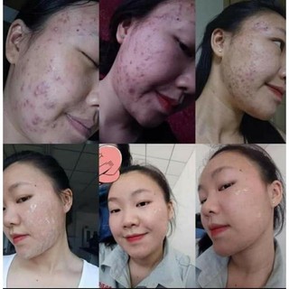 Serum Tái Tạo Da Nhân Sâm MQ ( chính hãng)