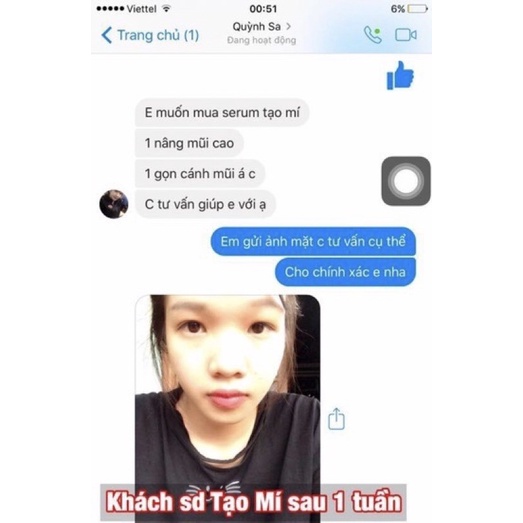 Tinh chất Miracle Pháp tạo mắt 2 mí, mở tròng mắt siêu hiệu quả