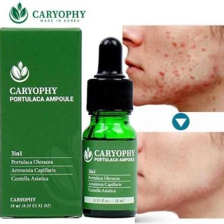 Serum Trị Mụn Thâm Dành Cho Da Nhờn Caryophy 1ml