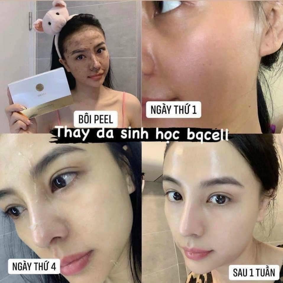 BQcell Derma Skin Peeling - Peel Da Vi Tảo Hàn Quốc