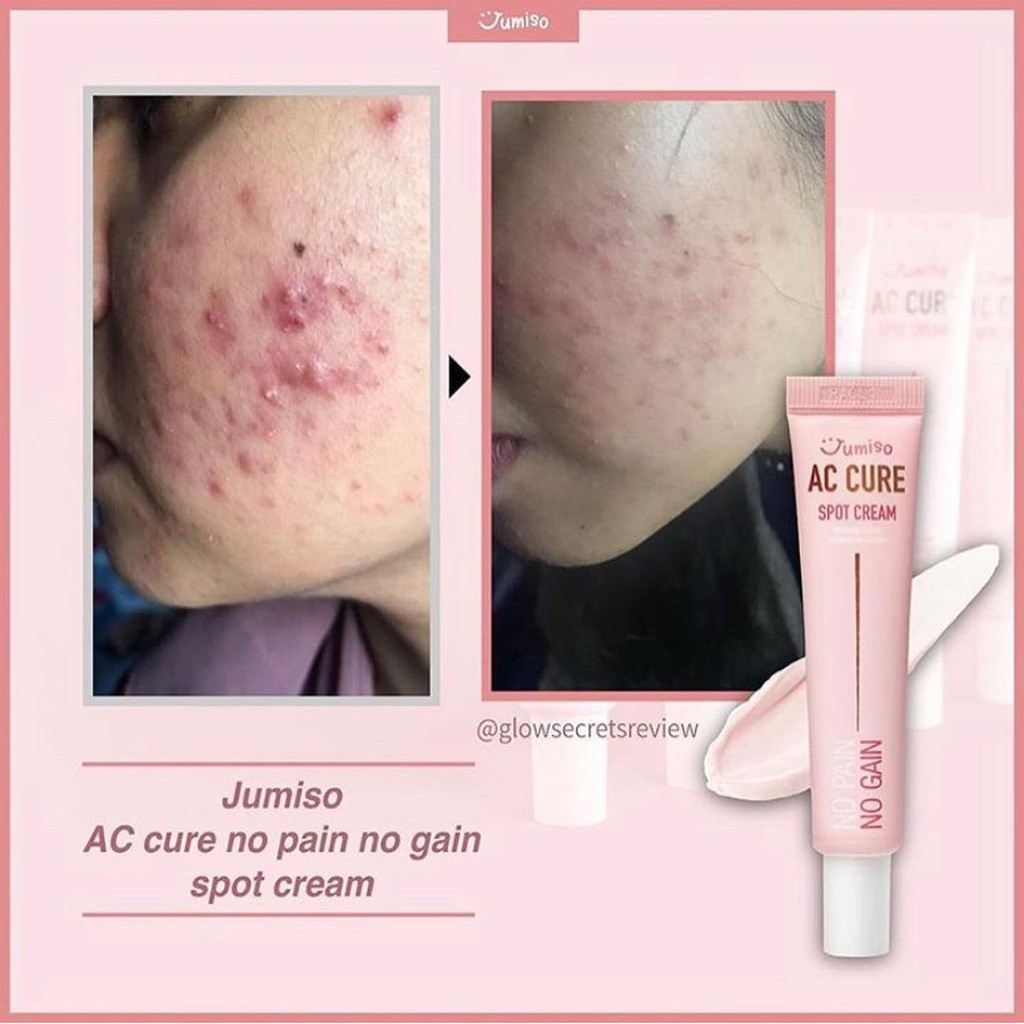 Kem loại bỏ mụn, giải độc, làm sáng da Jumiso Ac Cure No Pain No Gain Spot Cream 15g