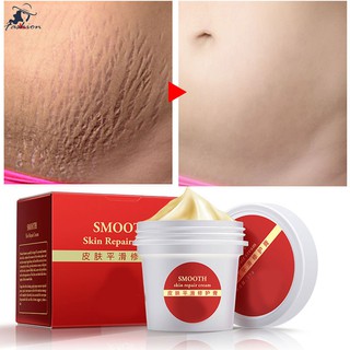 [Hàng mới về] Kem làm mịn vết rạn và sẹo trên da sau khi sinh