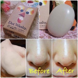 XÀ PHÒNG MỤN MŨI DOT WASHY