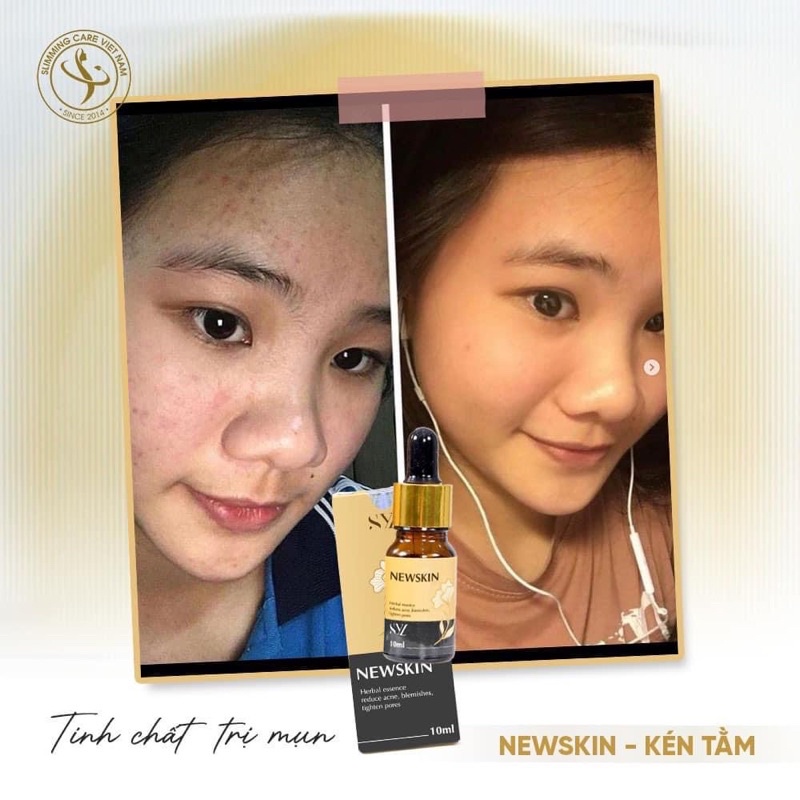 Tinh chất serum kén tằm Newskin Simming Sylic ngăn ngừa mụn chuyên sâu