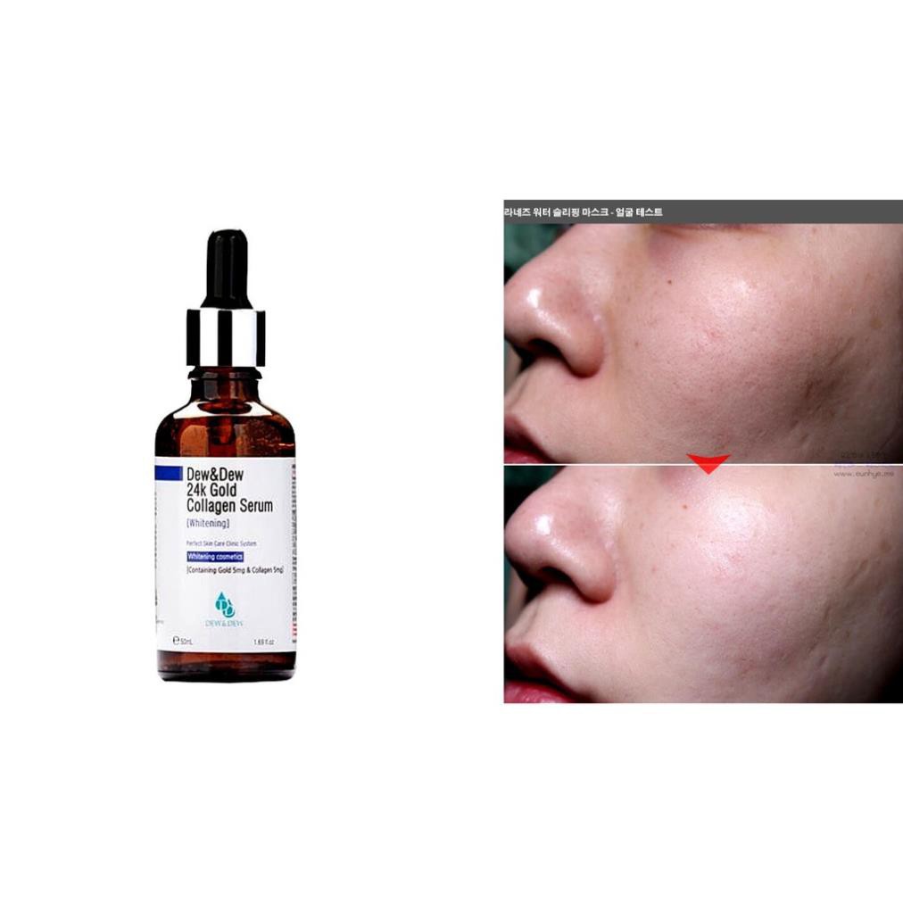 Serum Dew & Dew Vitamin C Treatment Chống Lão Hóa Tái Tạo Da Tươi Trẻ 50ml Hàn Quốc