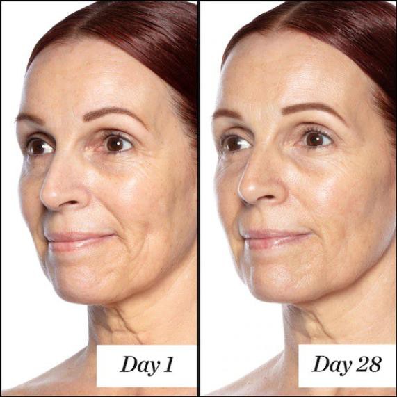 Serum dưỡng da Good Genes All-In-One Lactic Acid Treatment Unbox Vỏ Xấu