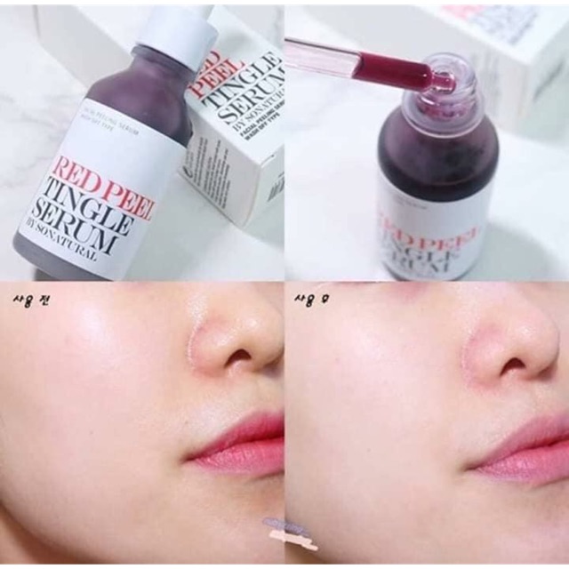 Red peel tingle serum