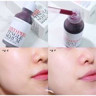Red peel tingle serum