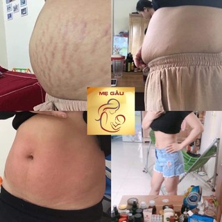 MUỐI THẢO DƯỢC - GIẢM EO SAU SINH