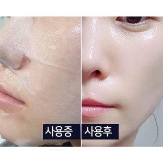 𝐌𝐚̣̆𝐭 𝐍𝐚̣ 𝐍𝐚̂𝐧𝐠 𝐂𝐨̛ 𝐆𝐮𝐛𝐨𝐧𝐜𝐡𝐨 𝐁𝐚𝐛𝐲 𝐅𝐚𝐜𝐞 𝐇𝐞𝐚𝐥𝐢𝐧𝐠 𝐌𝐚𝐬k