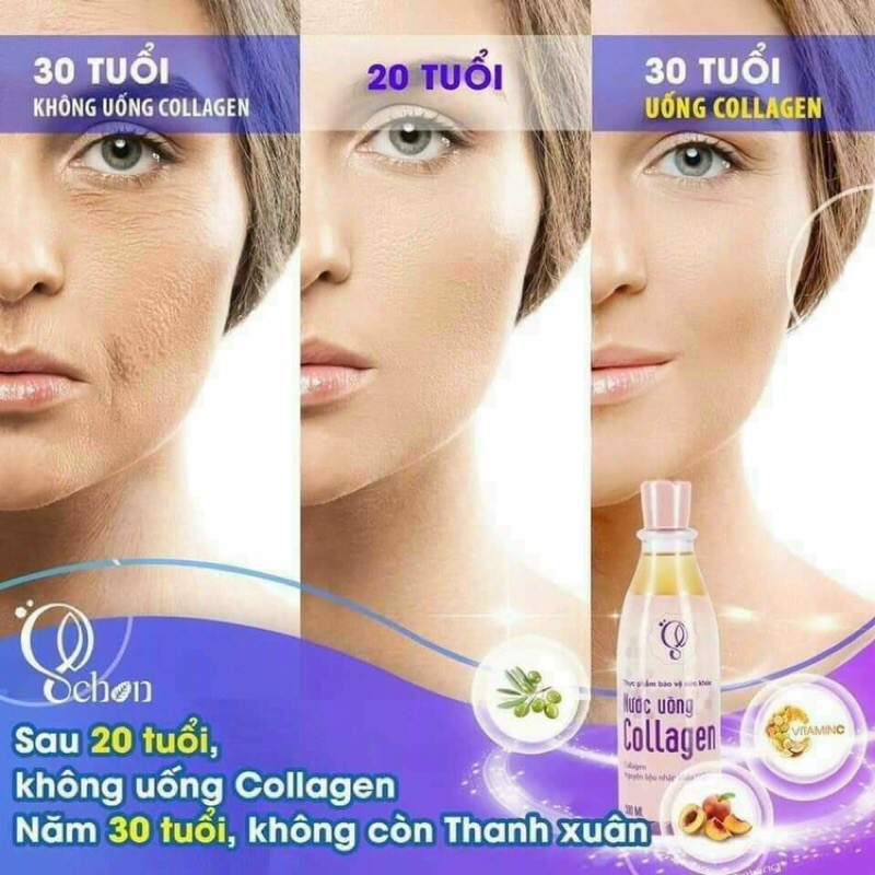 [HÀNG CHÍNH HÃNG] Nước Uống Collagen Schon - Chống lão hóa bổ sung Collagen | BigBuy360 - bigbuy360.vn