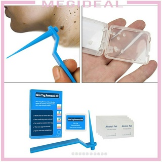 [Megideal] Sử dụng thiết bị xóa thẻ bổ sung