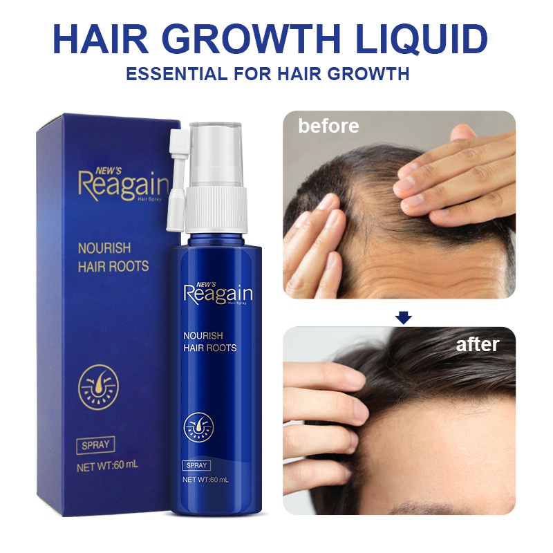 Tinh chất serum kích mọc tóc Kopyrrol dạng xịt 60ml