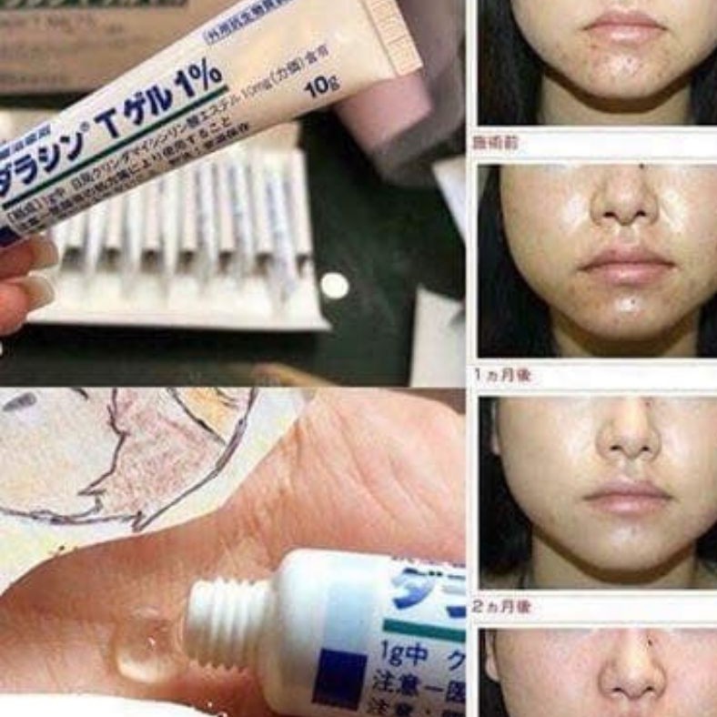 Gentacin 💕 Gentacin Nhật Bản - Chính hãng - Giảm thiểu việc hình thành sẹo và mụn | BigBuy360 - bigbuy360.vn