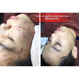 Noãn thực vật .