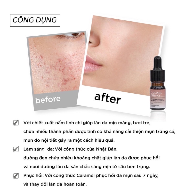 Serum Caramel Esence Viện Da Liễu Nhật Bản Giảm Mụn Dưỡng Da
