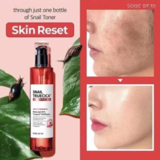 Nước Hoa Hồng 💝𝙁𝙍𝙀𝙀𝙎𝙃𝙄𝙋💝 Toner Hoa Hồng Some By Mi Snail Truecica Miracle Repair Toner 135ml - Mỹ Phẩm