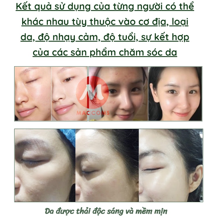 Mặt Nạ Ngủ Thạch Collagen YANJIAYI - Nâng Cơ Bổ Sung Collagen Cấp Nước Dưỡng Ẩm Căng Bóng, Thu nhỏ lỗ chân lông