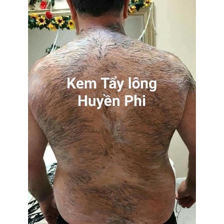 Serum Khử Mùi Hôi Nách INOD Huyền Phi, Hôi Chân, Mùi Cơ Thể, Serum triệt lông Huyền Phi | BigBuy360 - bigbuy360.vn