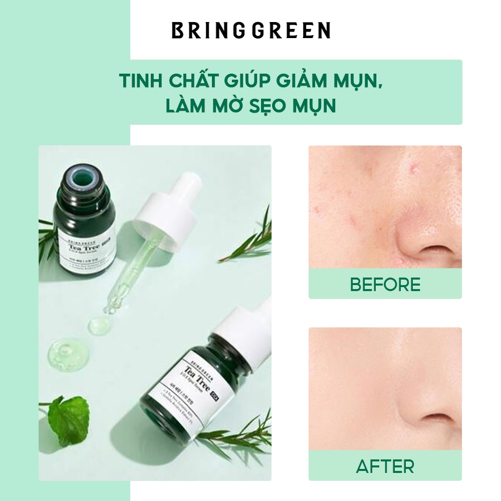 Tinh Chất Chấm Mụn Tràm Trà Bring Green Tea Tree Cica SOS Spot Serum 13ml (FOC Spot Patch)