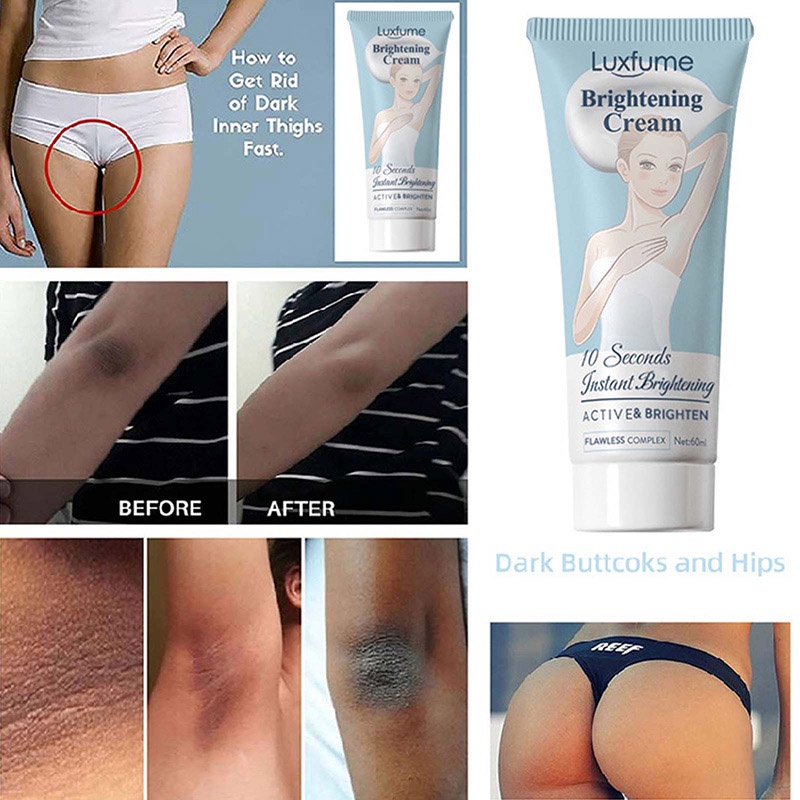 Kem hỗ trợ giảm thâm vùng da dưới cánh tay và đầu gối hiệu quả | BigBuy360 - bigbuy360.vn