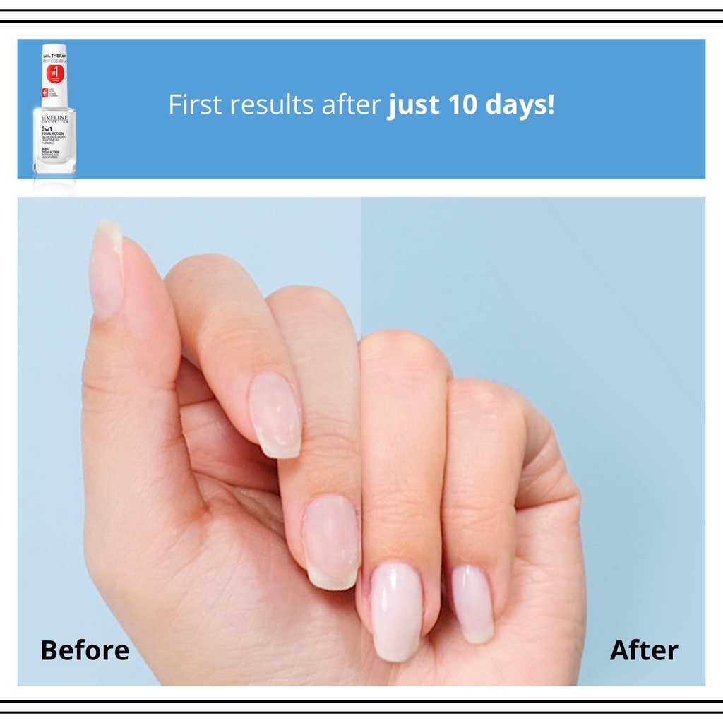 Sơn Dưỡng Móng Eveline 8in1 Total Action Nail Therapy Professional 12ml