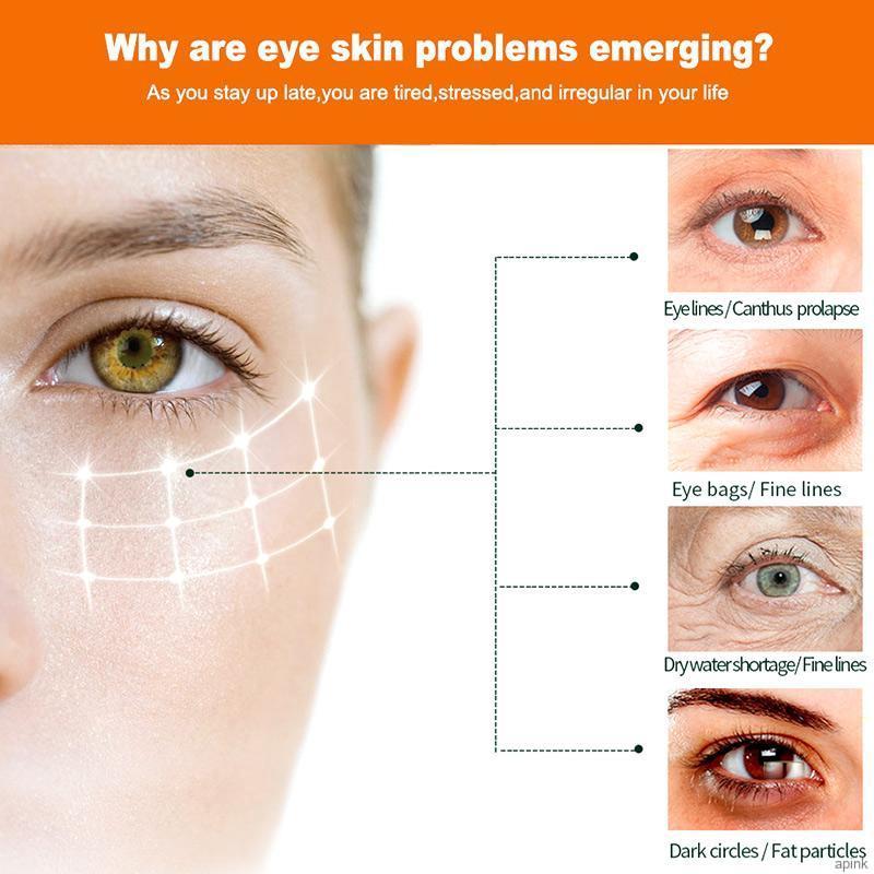 [Hàng mới về] Kem Dưỡng Da Vùng Mắt Loại Bỏ Quầng Thâm Và Nếp Nhăn Tiện Dụng 25g