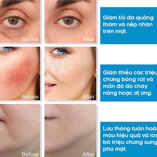 Quả cầu lạnh massage giúp tái tạo làm đẹp da, nâng cơ, làm sạch bã nhờn