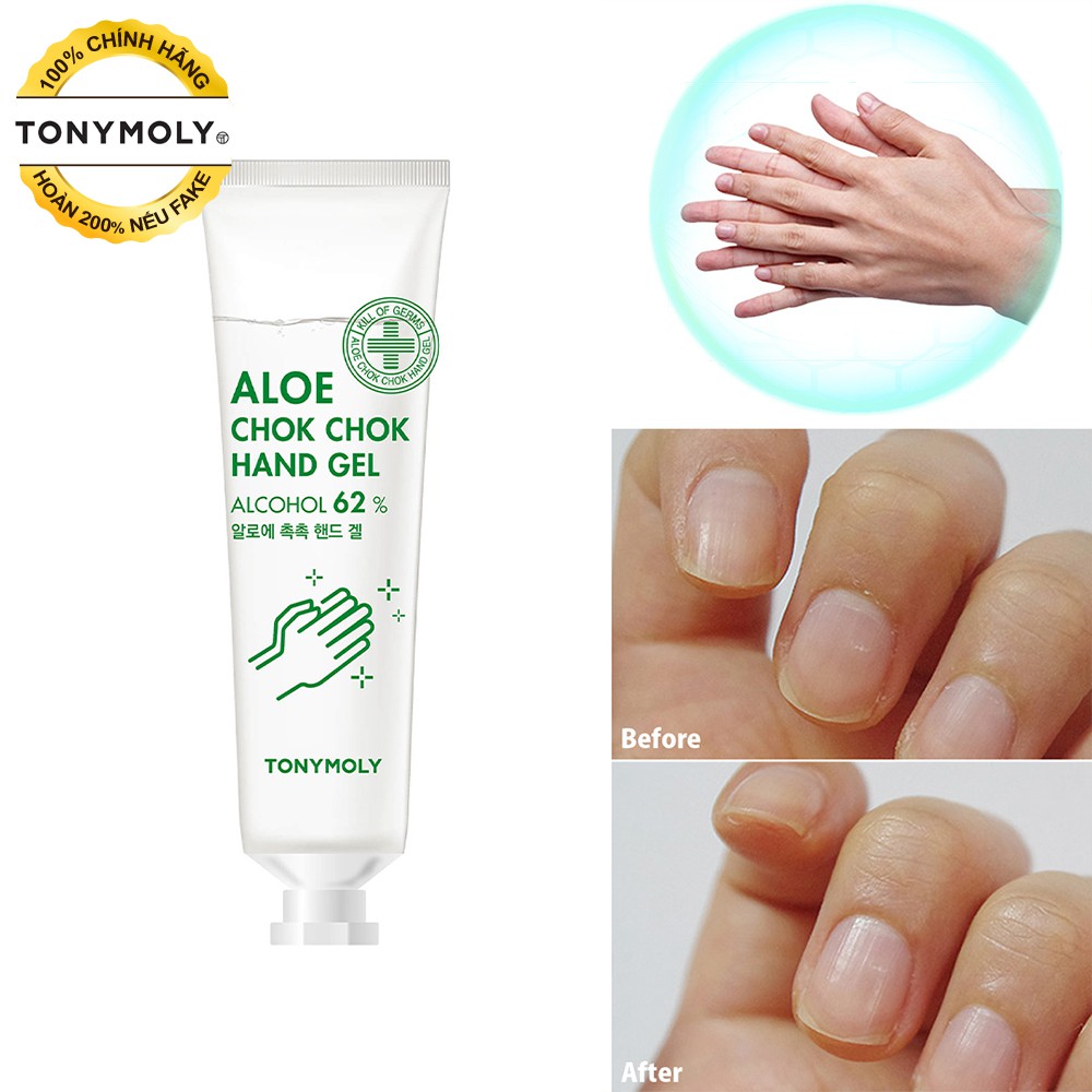 Gel rửa tay khô Tonymoly chiết xuất lô hội diệt khuẩn 99%