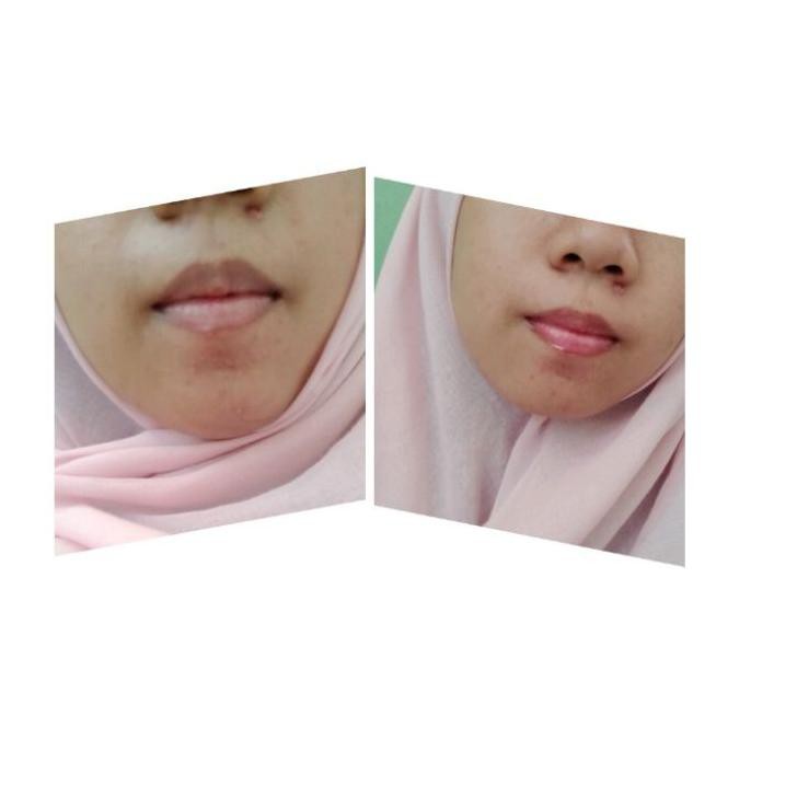 (hàng Mới Về) Serum Lanaf Dưỡng Môi Chính Hãng